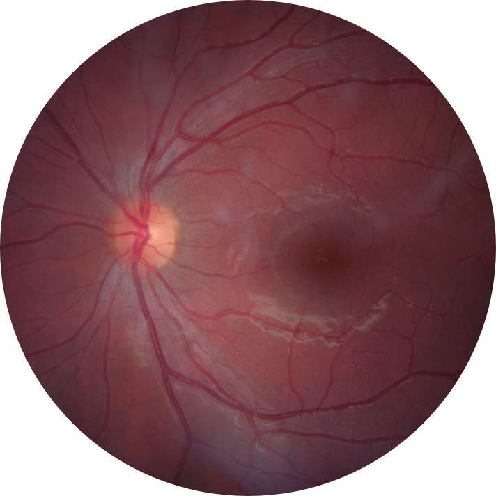 Joss-Copeman-Left-Eye